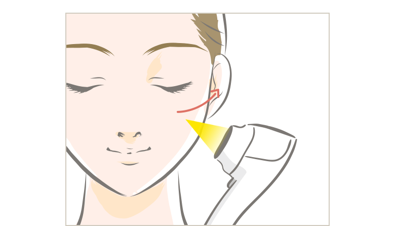 ダウンタイム：なし