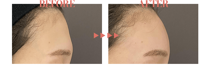 BEFORE / AFTER