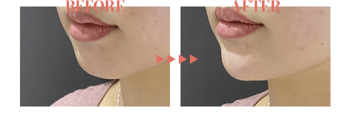 BEFORE / AFTER