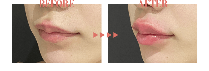 BEFORE / AFTER