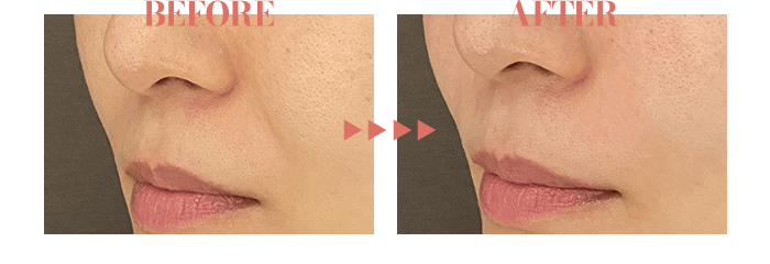 BEFORE / AFTER
