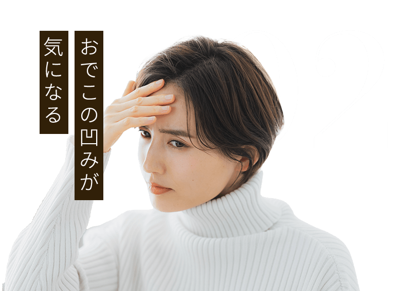 02：おでこの凹みが気になる