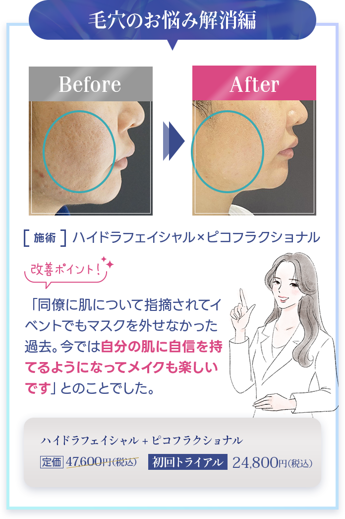毛穴のお悩み解消編 