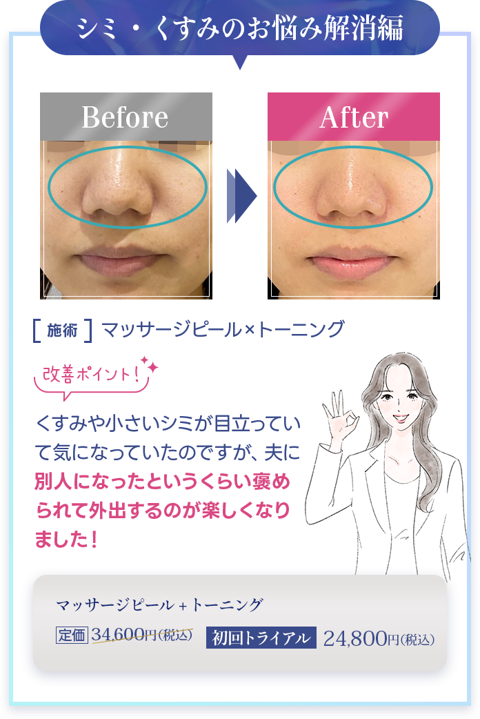 シミ・くすみのお悩み解消編
