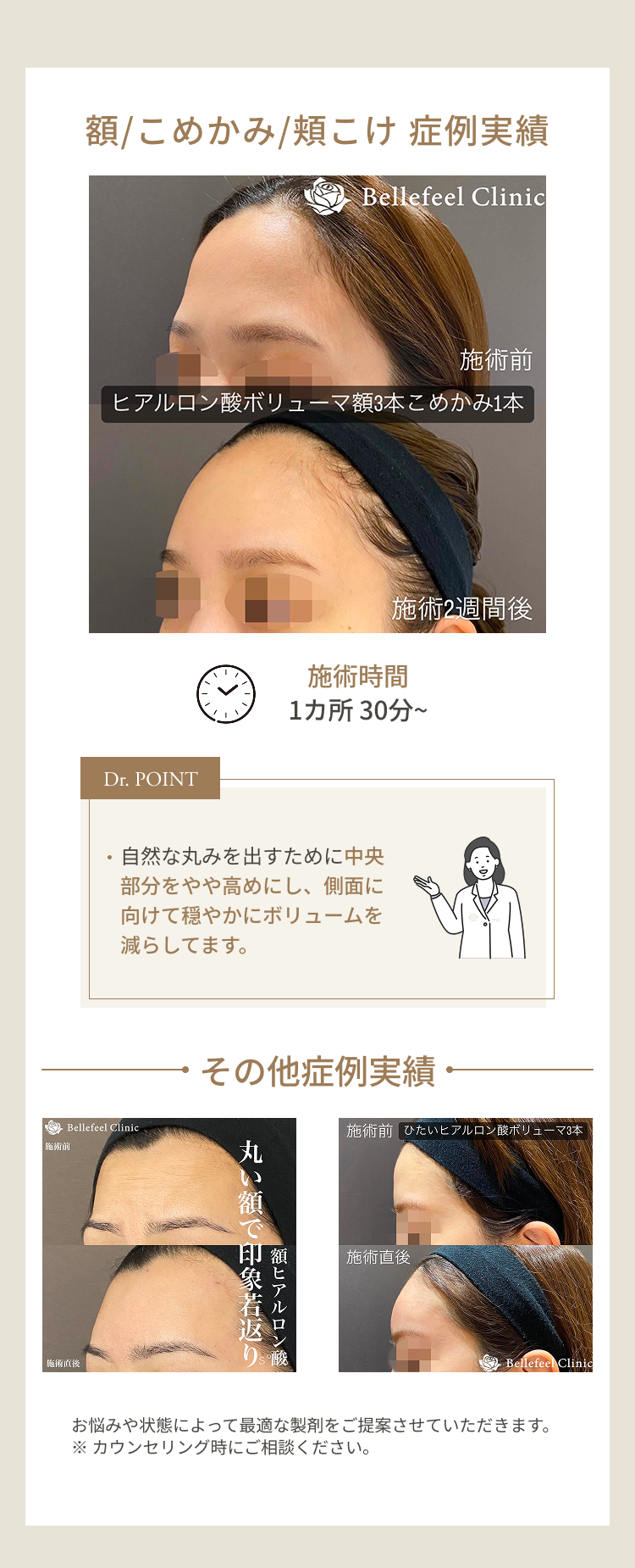 額の丸み 症例解説