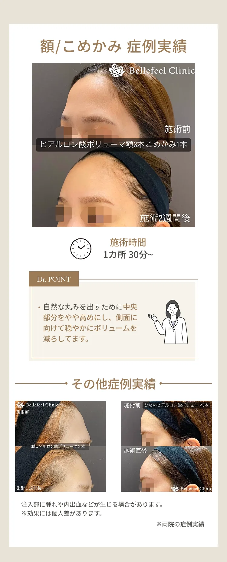 額の丸み 症例解説