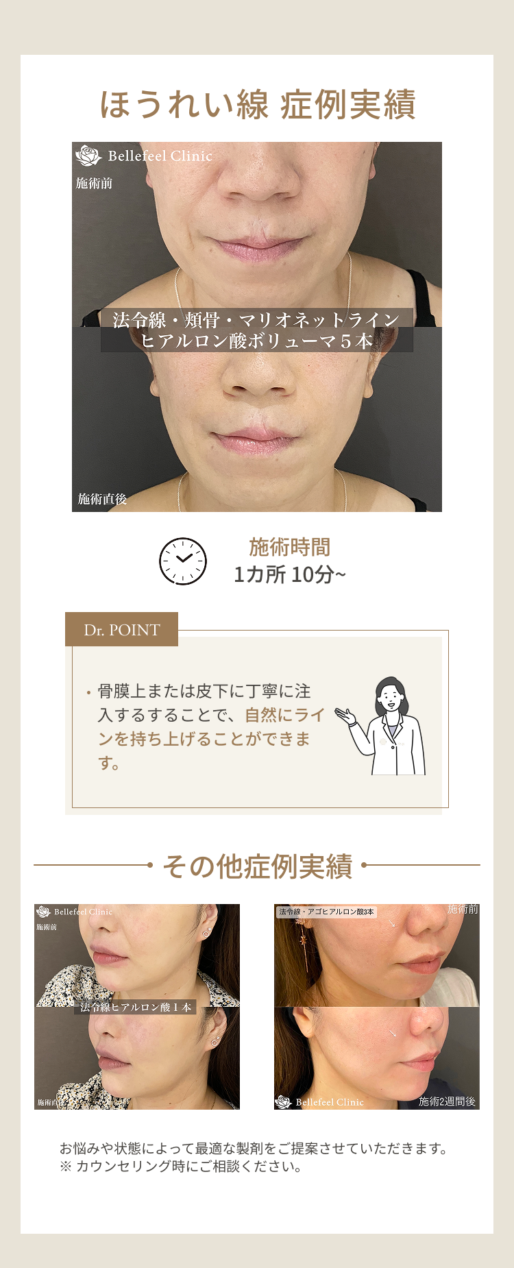 額しわ 症例解説