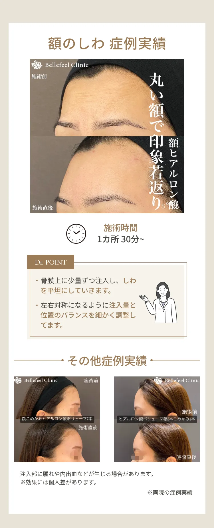 額しわ 症例解説
