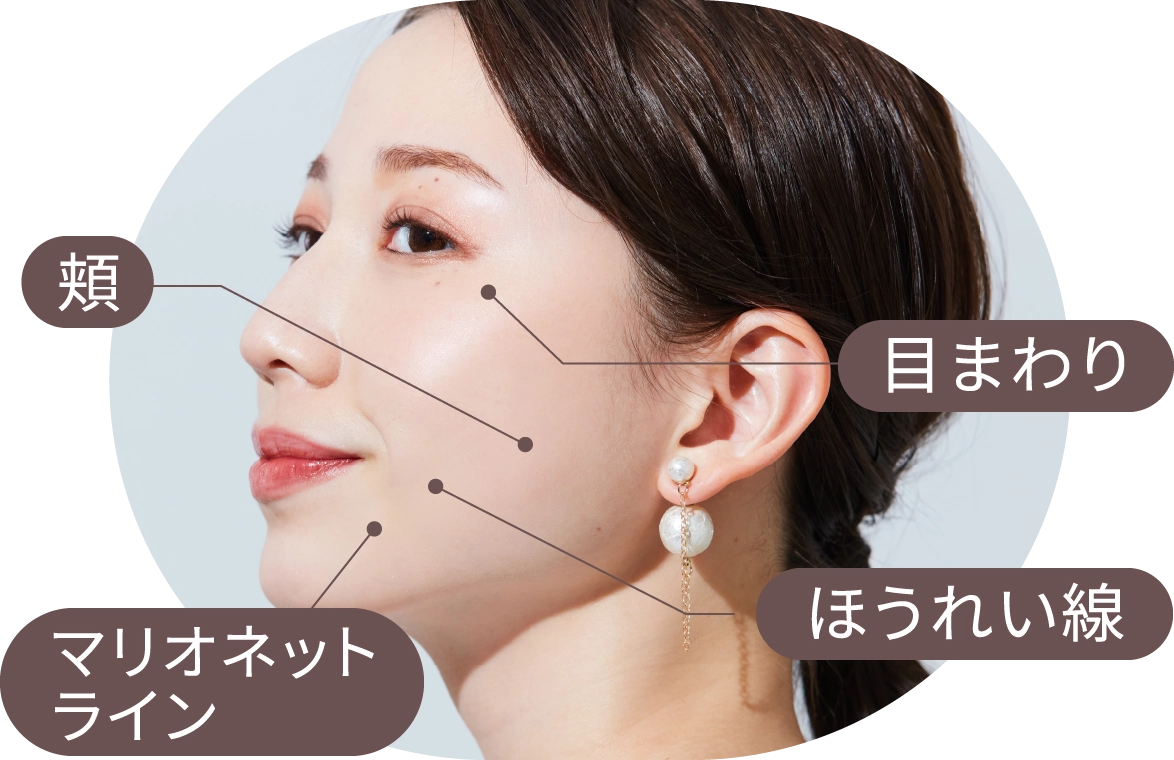 頬 目まわり ほうれい線 マリオネットライン